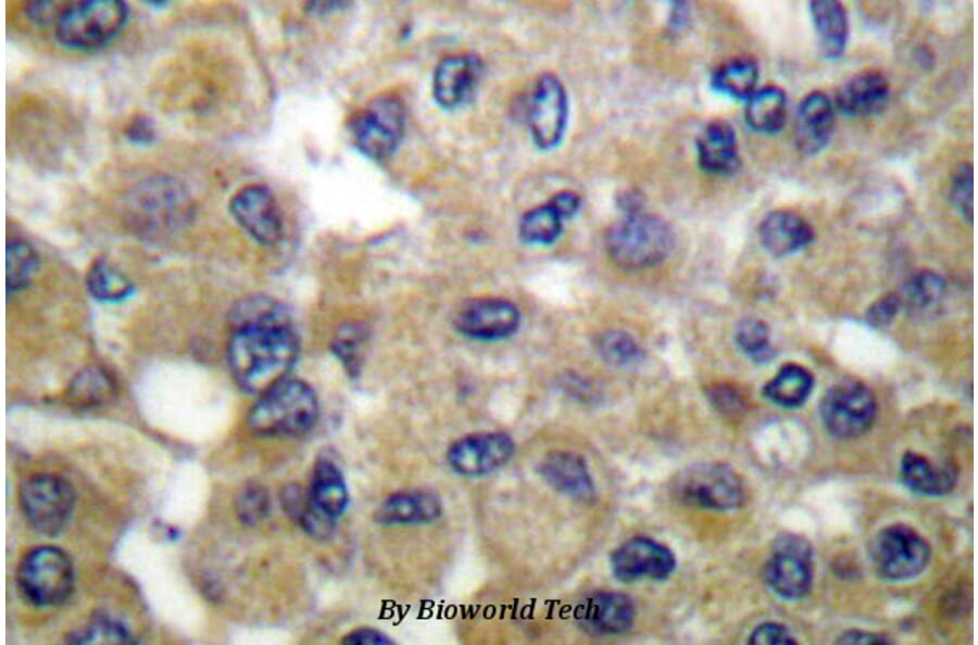 Anti-Mammaglobin B (K23) Antibody from Bioworld Technology (BS1218) - Antibodies.com