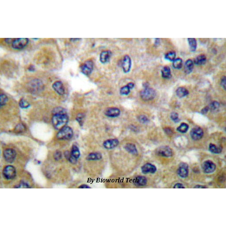 Anti-Mammaglobin B (K23) Antibody from Bioworld Technology (BS1218) - Antibodies.com