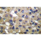 Anti-Mammaglobin B (K23) Antibody from Bioworld Technology (BS1218) - Antibodies.com