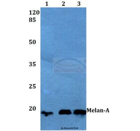 Anti-Melan-A (P75) Antibody from Bioworld Technology (BS1219) - Antibodies.com