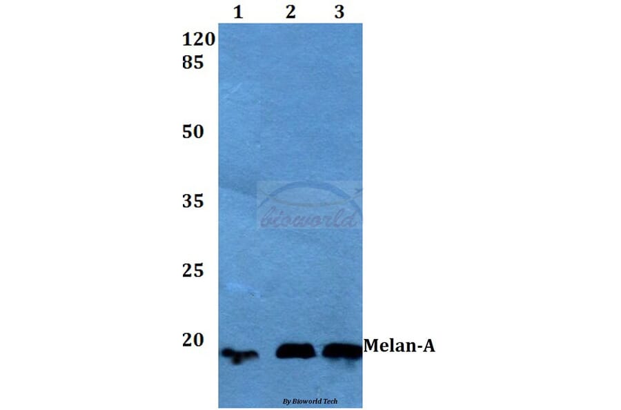 Anti-Melan-A (P75) Antibody from Bioworld Technology (BS1219) - Antibodies.com