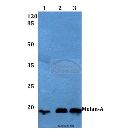 Anti-Melan-A (P75) Antibody from Bioworld Technology (BS1219) - Antibodies.com