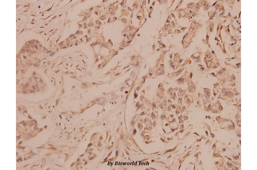 Anti-Melan-A (P75) Antibody from Bioworld Technology (BS1219) - Antibodies.com