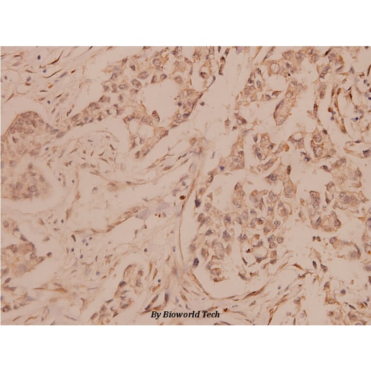 Anti-Melan-A (P75) Antibody from Bioworld Technology (BS1219) - Antibodies.com