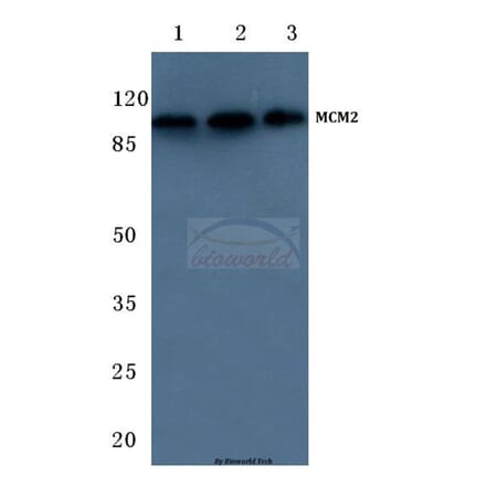 Anti-MCM2 / BM28 (A11) Antibody from Bioworld Technology (BS1221) - Antibodies.com