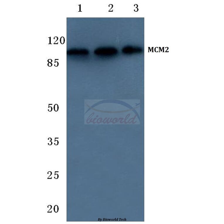 Anti-MCM2 / BM28 (A11) Antibody from Bioworld Technology (BS1221) - Antibodies.com