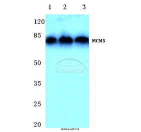 Anti-MCM5 (F51) Antibody from Bioworld Technology (BS1222) - Antibodies.com