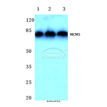 Anti-MCM5 (F51) Antibody from Bioworld Technology (BS1222) - Antibodies.com