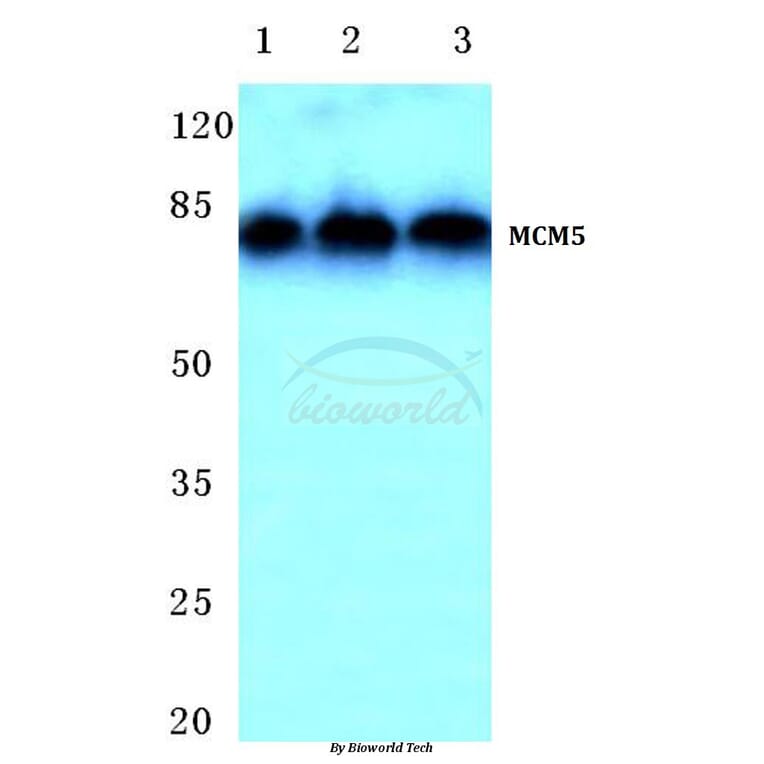 Anti-MCM5 (F51) Antibody from Bioworld Technology (BS1222) - Antibodies.com