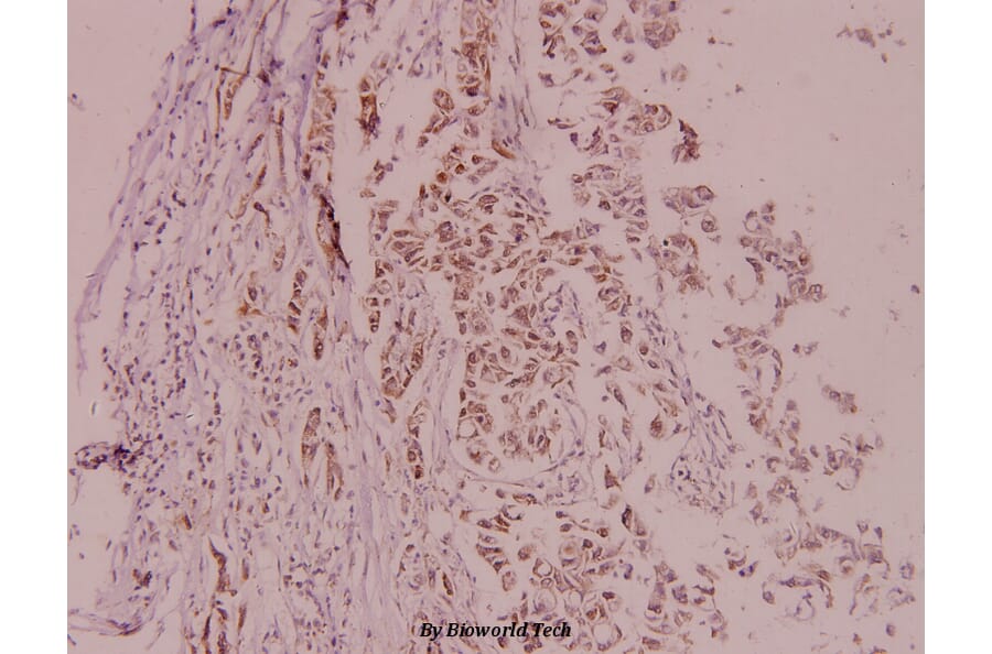 Anti-MDM2 (F414) Antibody from Bioworld Technology (BS1223) - Antibodies.com