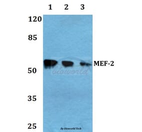 Anti-MEF-2 (A306) Antibody from Bioworld Technology (BS1224) - Antibodies.com