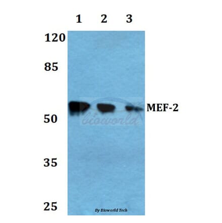 Anti-MEF-2 (A306) Antibody from Bioworld Technology (BS1224) - Antibodies.com