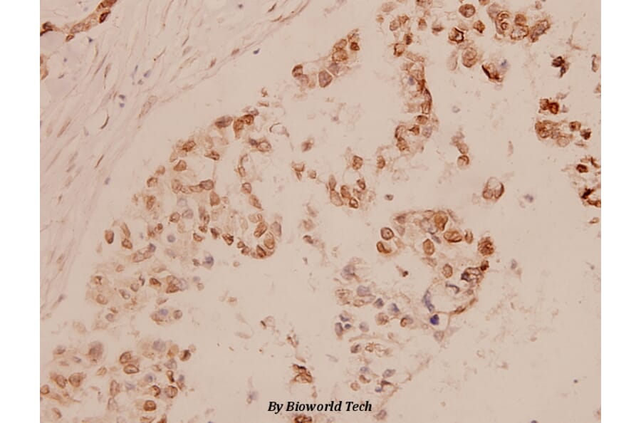 Anti-MEF-2 (A306) Antibody from Bioworld Technology (BS1224) - Antibodies.com
