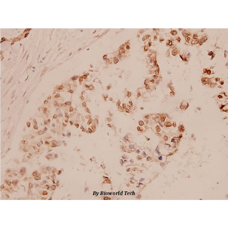Anti-MEF-2 (A306) Antibody from Bioworld Technology (BS1224) - Antibodies.com