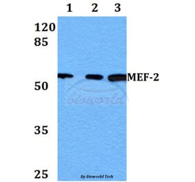 Anti-MEF-2 (P313) Antibody from Bioworld Technology (BS1225) - Antibodies.com