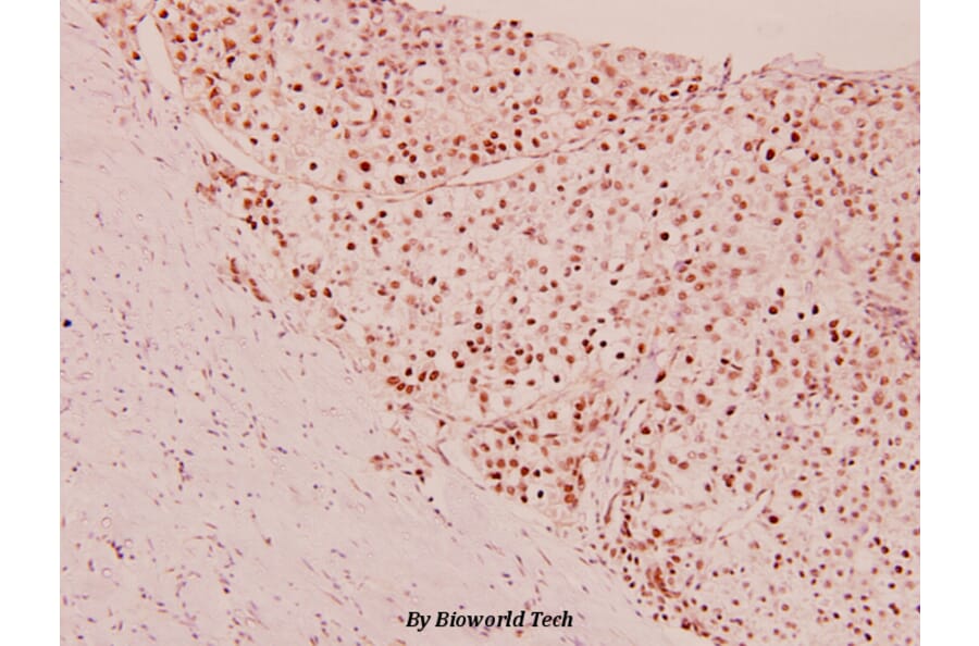 Anti-MEF-2 (P313) Antibody from Bioworld Technology (BS1225) - Antibodies.com