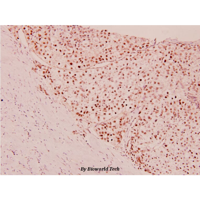 Anti-MEF-2 (P313) Antibody from Bioworld Technology (BS1225) - Antibodies.com