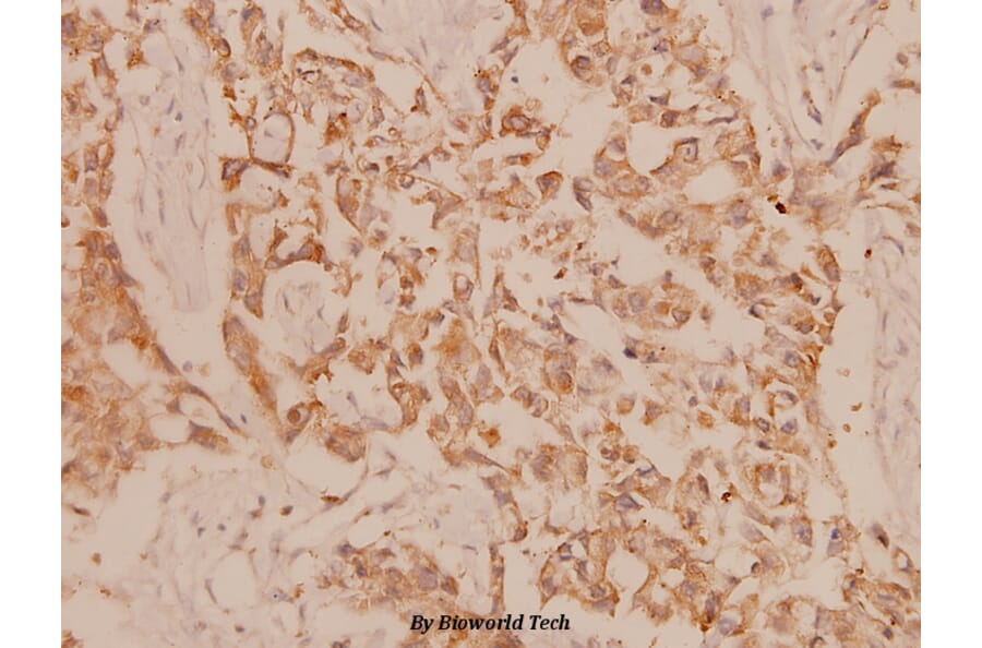 Anti-MEK-3 (S183) Antibody from Bioworld Technology (BS1227) - Antibodies.com