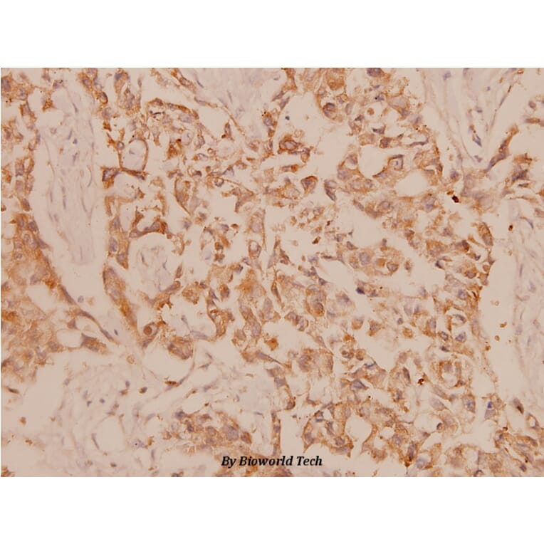 Anti-MEK-3 (S183) Antibody from Bioworld Technology (BS1227) - Antibodies.com