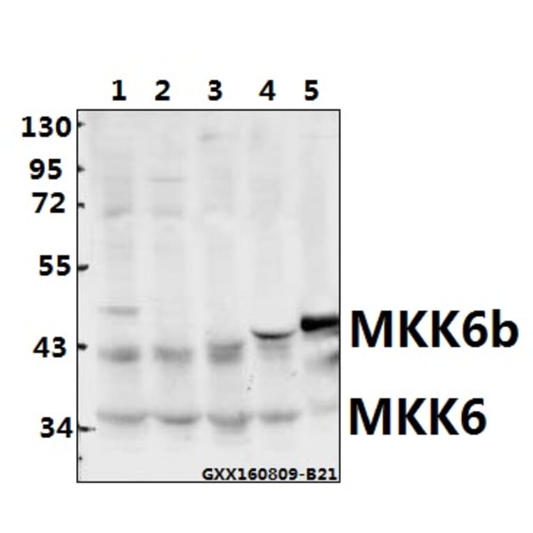 Anti-MEK-6 (S201) Antibody from Bioworld Technology (BS1228) - Antibodies.com