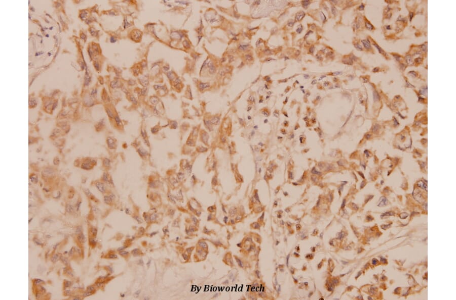 Anti-MEK-6 (S201) Antibody from Bioworld Technology (BS1228) - Antibodies.com
