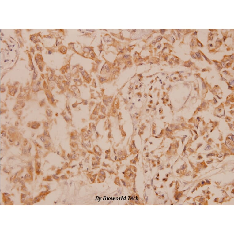 Anti-MEK-6 (S201) Antibody from Bioworld Technology (BS1228) - Antibodies.com