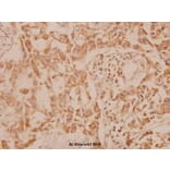 Anti-MEK-6 (S201) Antibody from Bioworld Technology (BS1228) - Antibodies.com