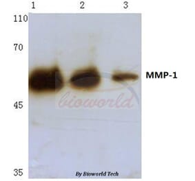 Anti-MMP-1 (H440) Antibody from Bioworld Technology (BS1229) - Antibodies.com