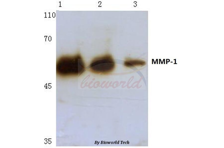 Anti-MMP-1 (H440) Antibody from Bioworld Technology (BS1229) - Antibodies.com