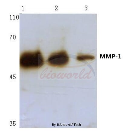Anti-MMP-1 (H440) Antibody from Bioworld Technology (BS1229) - Antibodies.com