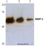 Anti-MMP-1 (H440) Antibody from Bioworld Technology (BS1229) - Antibodies.com