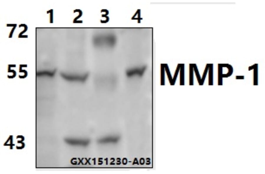 Anti-MMP-1 (H440) Antibody from Bioworld Technology (BS1229) - Antibodies.com