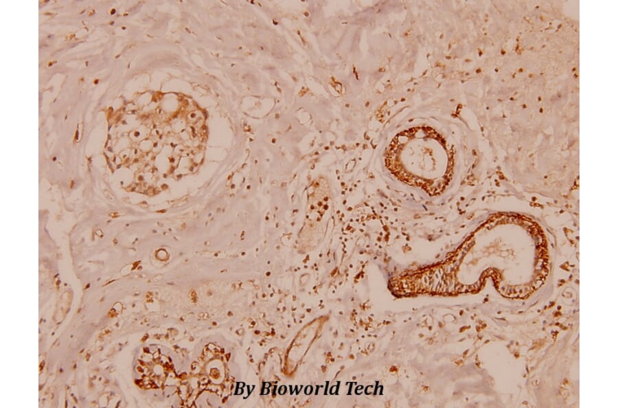 Anti-MMP-11 (G88) Antibody from Bioworld Technology (BS1230) - Antibodies.com
