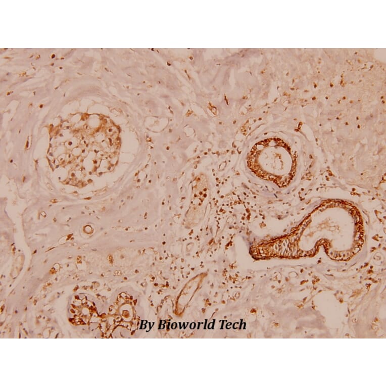 Anti-MMP-11 (G88) Antibody from Bioworld Technology (BS1230) - Antibodies.com