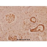 Anti-MMP-11 (G88) Antibody from Bioworld Technology (BS1230) - Antibodies.com