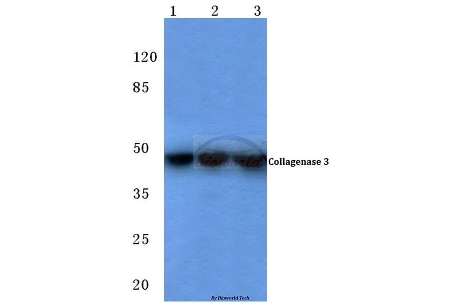 Anti-MMP-13 (L22) Antibody from Bioworld Technology (BS1231) - Antibodies.com
