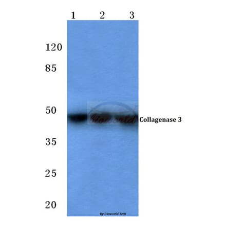 Anti-MMP-13 (L22) Antibody from Bioworld Technology (BS1231) - Antibodies.com