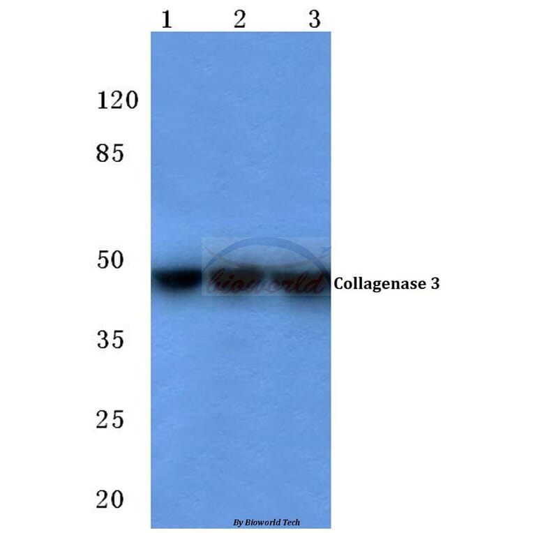 Anti-MMP-13 (L22) Antibody from Bioworld Technology (BS1231) - Antibodies.com