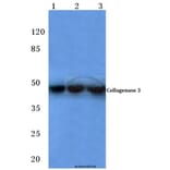 Anti-MMP-13 (L22) Antibody from Bioworld Technology (BS1231) - Antibodies.com