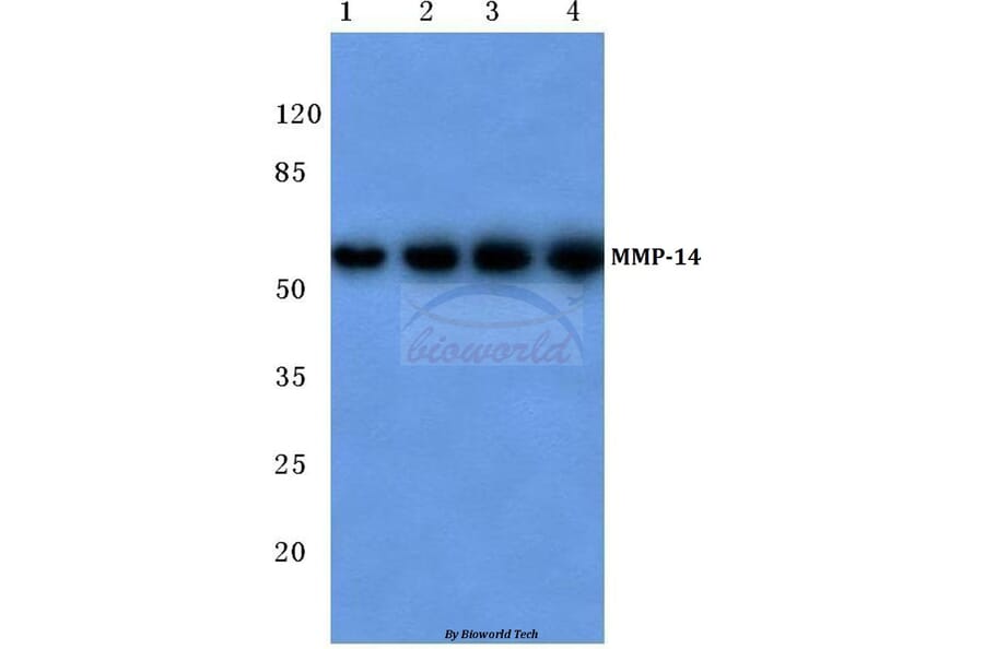 Anti-MMP-14 (P509) Antibody from Bioworld Technology (BS1232) - Antibodies.com