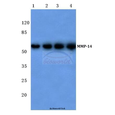 Anti-MMP-14 (P509) Antibody from Bioworld Technology (BS1232) - Antibodies.com