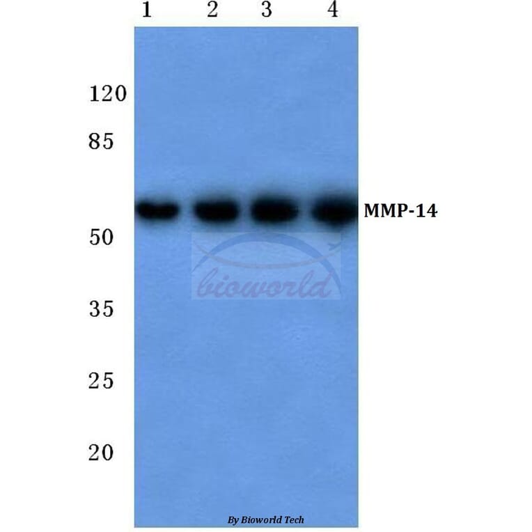 Anti-MMP-14 (P509) Antibody from Bioworld Technology (BS1232) - Antibodies.com