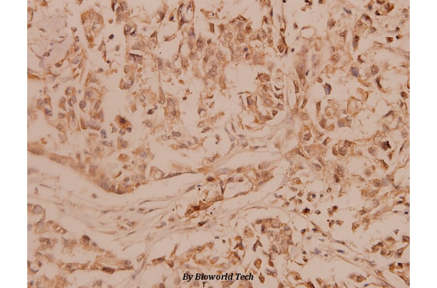 Anti-MMP-14 (P509) Antibody from Bioworld Technology (BS1232) - Antibodies.com
