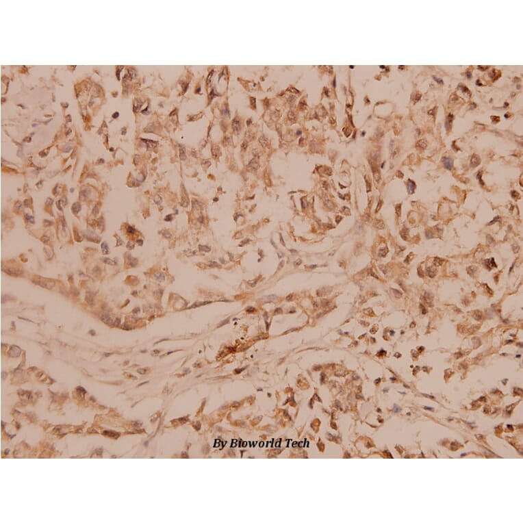 Anti-MMP-14 (P509) Antibody from Bioworld Technology (BS1232) - Antibodies.com