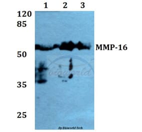 Anti-MMP-16 (T583) Antibody from Bioworld Technology (BS1234) - Antibodies.com