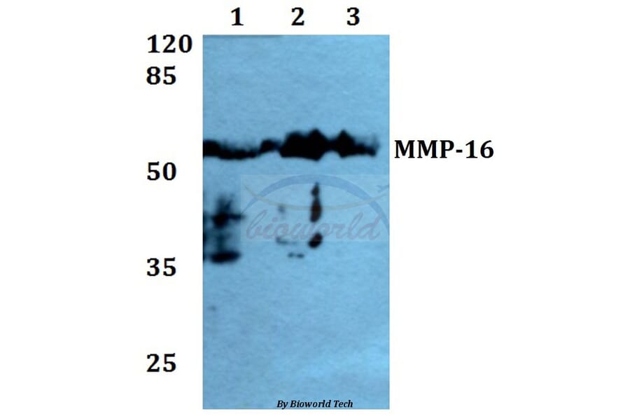 Anti-MMP-16 (T583) Antibody from Bioworld Technology (BS1234) - Antibodies.com
