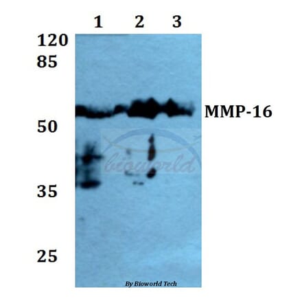 Anti-MMP-16 (T583) Antibody from Bioworld Technology (BS1234) - Antibodies.com