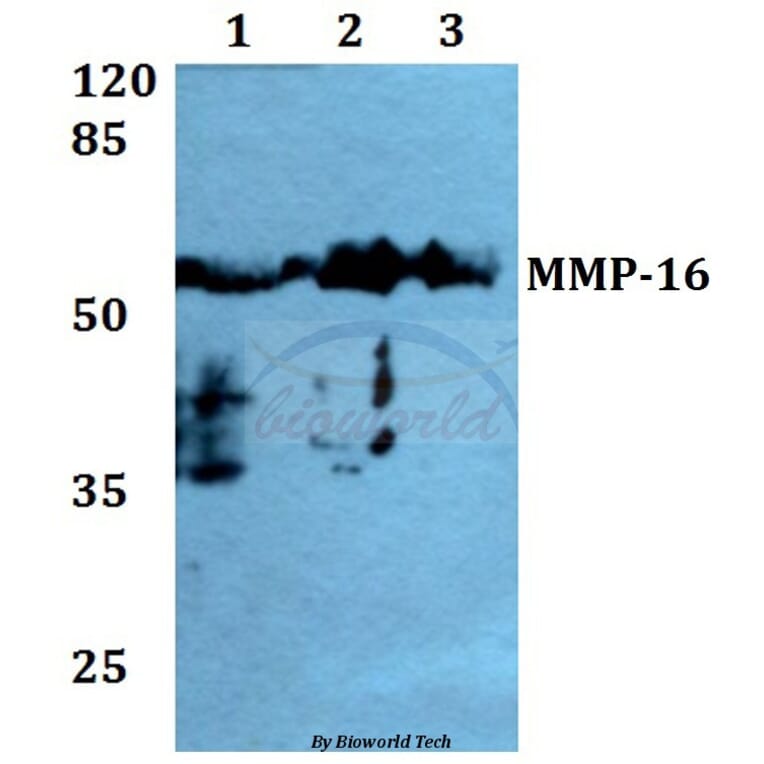 Anti-MMP-16 (T583) Antibody from Bioworld Technology (BS1234) - Antibodies.com