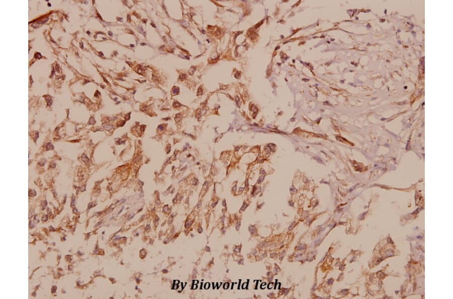 Anti-MMP-16 (T583) Antibody from Bioworld Technology (BS1234) - Antibodies.com