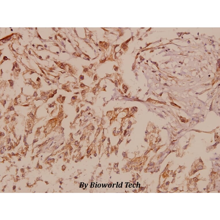 Anti-MMP-16 (T583) Antibody from Bioworld Technology (BS1234) - Antibodies.com